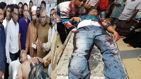 সদর উপজেলা স্বেচ্ছাসেবক লীগের আহবায়কের উপর হামলা, অবস্থা আশংকাজনক