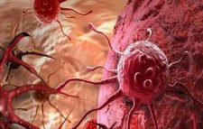 প্রতিদিনের যেসব ভুল ক্যানসার ডেকে আনে, বাঁচতে কী করবেন?