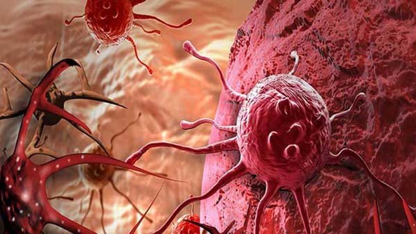 প্রতিদিনের যেসব ভুল ক্যানসার ডেকে আনে, বাঁচতে কী করবেন?