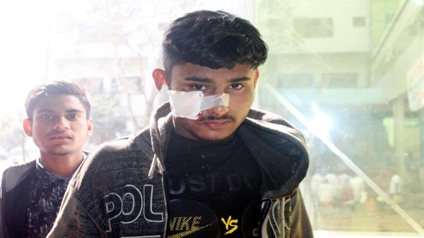 দক্ষিণ সুরমায় সি এন জি দুঘর্টনায় আহত ২