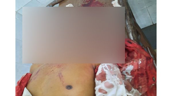 মদিনা মার্কেটে এক চালককে পিষে মারল আরেক অটোরিকশা চালক