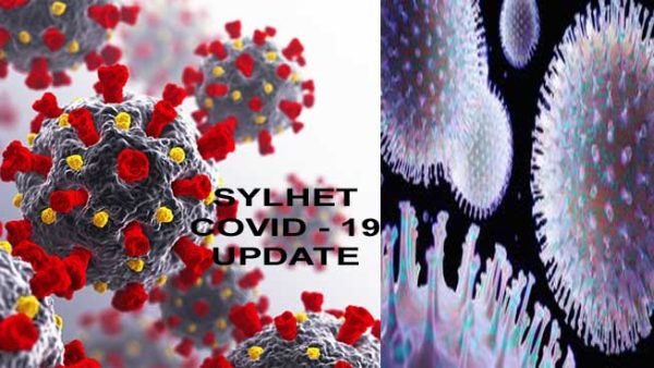 ২৪ঘন্টায় সিলেটে ২টি ল্যাবে ৭৪ জন পজেটিভ