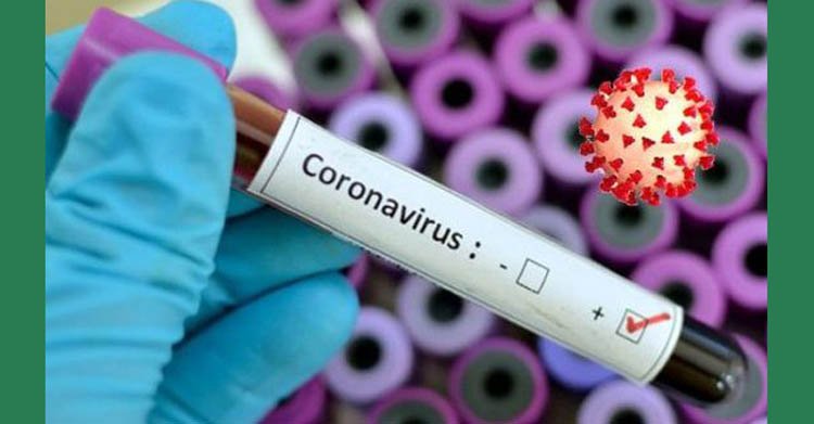 সিলেটে করোনায় এক কয়েদীর মৃত্যু, মোট পজেটিভ সনাক্ত ৮ জন,