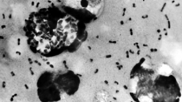 চীনে এবার বিউবোনিক প্লেগ রোগের কারণে সতর্কতা জারি।