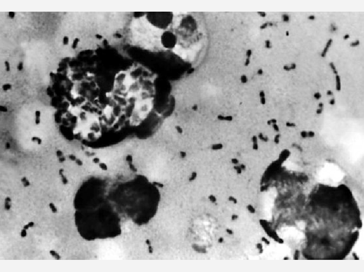 চীনে এবার বিউবোনিক প্লেগ রোগের কারণে সতর্কতা জারি।