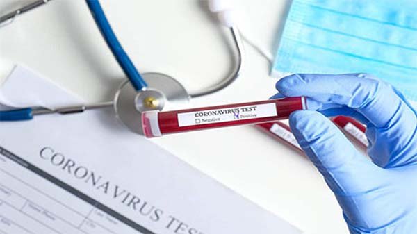 ২৪ ঘণ্টায় করোনায় আরো ২১ জনের মৃত্যু, শনাক্ত ১৩৮৩