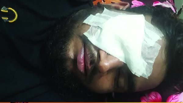 সার্কিট হাউসের সামনে পরিবহণ শ্রমিকদের হামলায় দুই সহোদর আহত