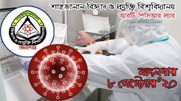 শাবির ল্যাবে ২৮২ নমুনা পরীক্ষায় ‘করোনা পজিটিভ’ ৩৩
