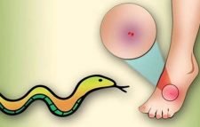 নাটোরে ঘুমন্ত ননদ-ভাবিকে সাপের দংশন