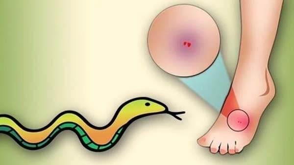 নাটোরে ঘুমন্ত ননদ-ভাবিকে সাপের দংশন