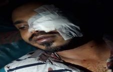 বখাটের ছুরিকাঘাতে দুই ভাই আহত