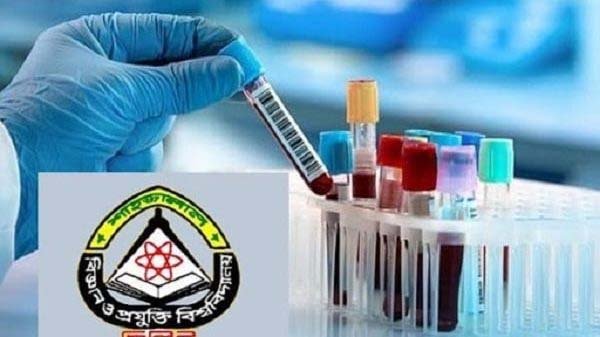 শাবির ল্যাবে আরো ৭৩জনের করোনা শনাক্ত