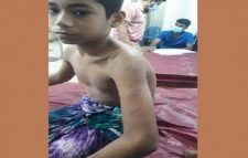 কুলাউড়ায় শিক্ষকের বেত্রাঘাতে গুরুতর আহত মাদরাসাছাত্র