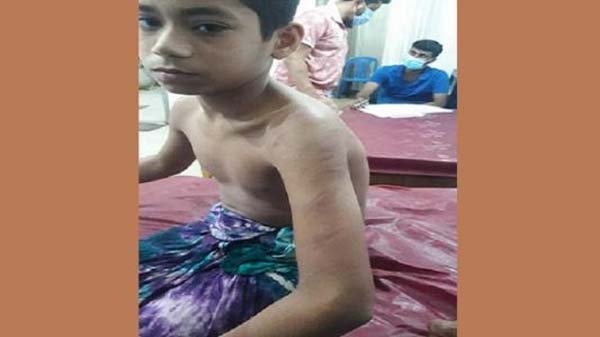 কুলাউড়ায় শিক্ষকের বেত্রাঘাতে গুরুতর আহত মাদরাসাছাত্র