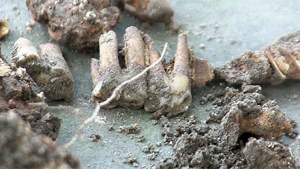 রংপুর এক কুয়ায় মিললো মানুষের হাড় ও দাঁত