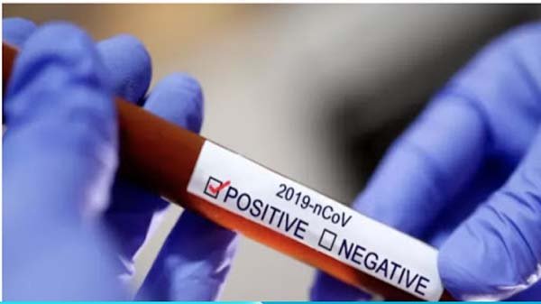 একদিনে সিলেটে ৪৩ জন শনাক্ত