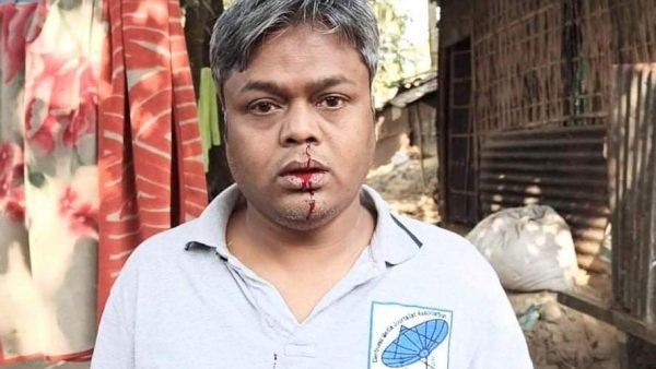 সাদিকুর রহমান সাকীর উপর সন্ত্রাসী হামলার ঘটনায় নিন্দা প্রকাশ স্পোর্টস জার্নালিষ্ট ফোরাম বাংলাদেশ’র