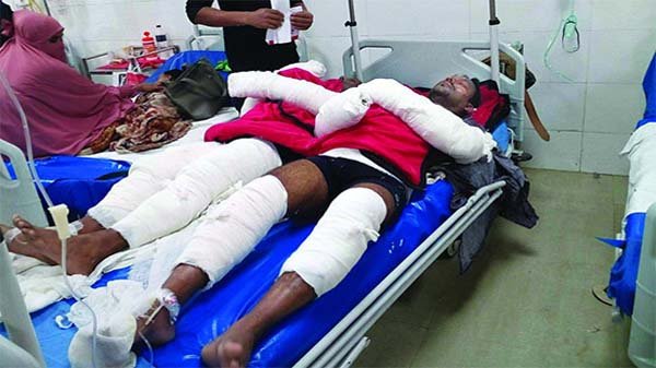 ঢাকায় ওয়ার্কশপে বিস্ফোরণ, দগ্ধ ৭