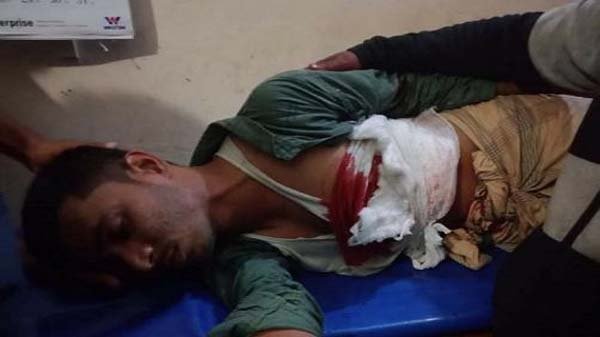 তাহিরপুরে তরুণকে কোপালো দুর্বৃত্তরা