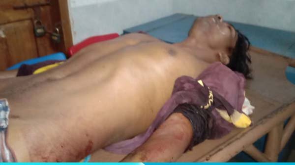 ‘ভাগ্নের’ ছুরিকাঘাতে ‘মামা’ খুন