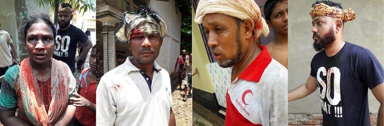 দক্ষিণ সুরমার লালাবাজারের হামলায় মহিলাসহ আহত ৬