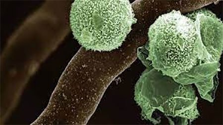 এবার নতুন উদ্বেগের নাম গ্রিন ফাঙ্গাস..