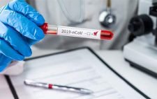 নাটোরে ২৪ ঘণ্টায় ১৪৫ জন আক্রান্ত