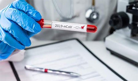 নাটোরে ২৪ ঘণ্টায় ১৪৫ জন আক্রান্ত