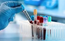 টিকার কার্যকারিতা জানা যাবে রক্ত পরীক্ষায়