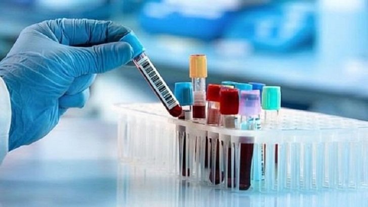 দেশে মানুষের দেহে অ্যান্টিবডি শনাক্ত