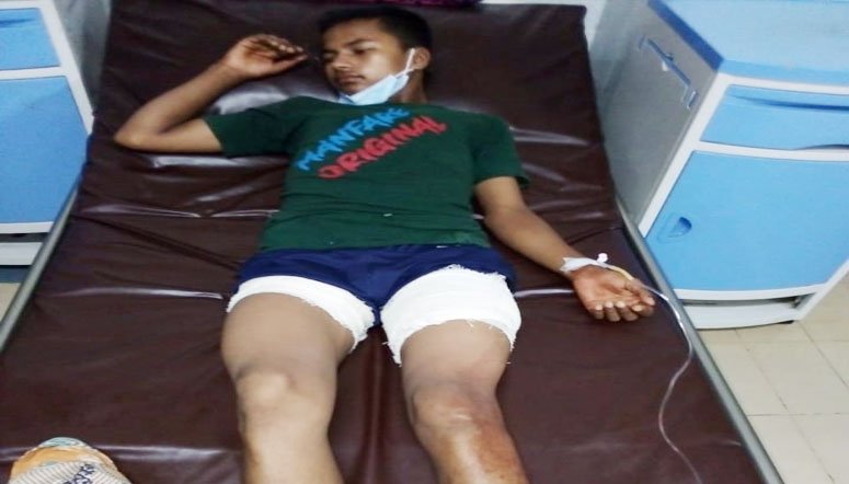 ছাতকে কিশোরকে কুপিয়ে আহত, হাসপাতালে ভর্তি