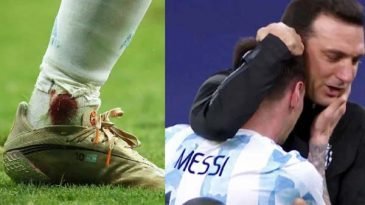 রক্তঝরা পা নিয়ে দুর্দান্ত পারফর্ম, মেসির প্রশংসায় কোচ