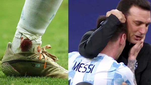 রক্তঝরা পা নিয়ে দুর্দান্ত পারফর্ম, মেসির প্রশংসায় কোচ