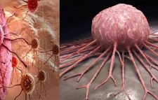 টিউমার ও ক্যানসার কি সমান নাকি ২টি দুই ধরনের ?