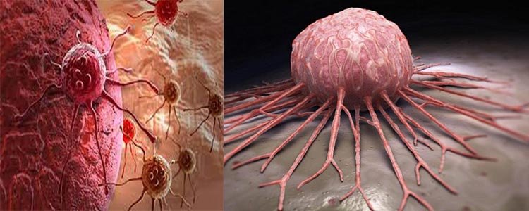 টিউমার ও ক্যানসার কি সমান নাকি ২টি দুই ধরনের ?