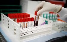 আগস্টের শুরুতে ১ কোটি ১০ লাখ টিকা আসছে