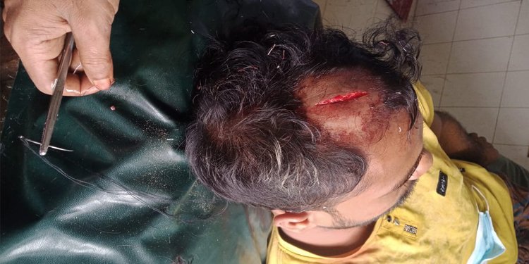 দিরাইয়ে ছোট ভাইকে কোপাল বড় ভাই  