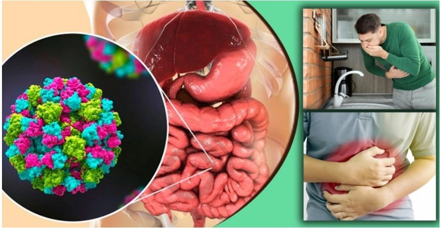 নতুন আতঙ্ক নরোভাইরাস, শিশুদের জন্য বিপজ্জনক