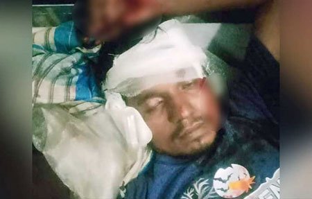 আখাউড়ায় চলন্ত ট্রেনে ছুরি দিয়ে ঢিল, হকার আহত