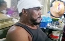 সিলেটের এয়ারপোর্টে সৎ ভাইয়ের দায়ের কুপে আহত আরেক ভাই