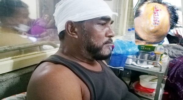 সিলেটের এয়ারপোর্টে সৎ ভাইয়ের দায়ের কুপে আহত আরেক ভাই