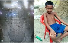 শরীরে শত শত স্প্লিন্টার, হাসপাতালে কাতরাচ্ছে শিশু তফাজ্জল