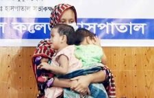 আলাদা হলো লাবিবা-লামিসা, ফিরেছে জ্ঞান