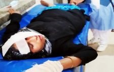 ইজিবাইকের চাকার সাথে বোরকার পেঁচিয়ে রোজিনা বেগম গুরুত্বরভাবে আহত