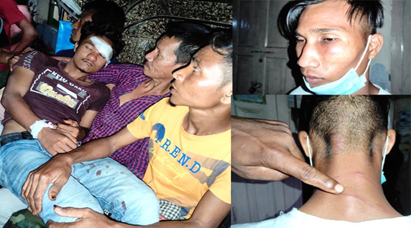 বড়লেখায় ফুটবল খেলায় আদিবাসী যুবকদের ওপর হামলা, আহত ৪