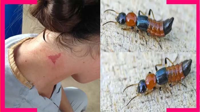 ‘নাইরোবি ফ্লাই’ আতঙ্ক পশ্চিমবঙ্গে