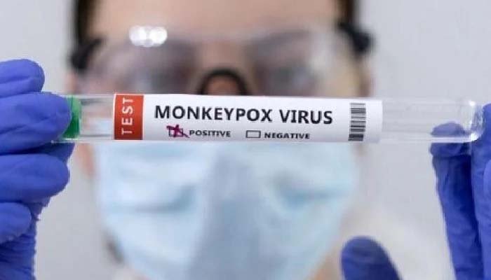 স্পেন ও ব্রাজিলে মাঙ্কিপক্সে প্রথম মৃত্যু