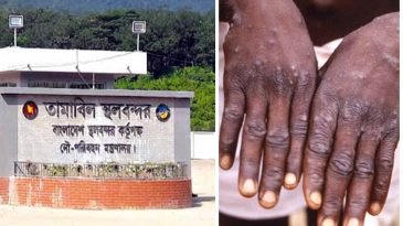 মাঙ্কিপক্স : সিলেটের স্থলবন্দরগুলোতে বাড়তি সতর্কতা