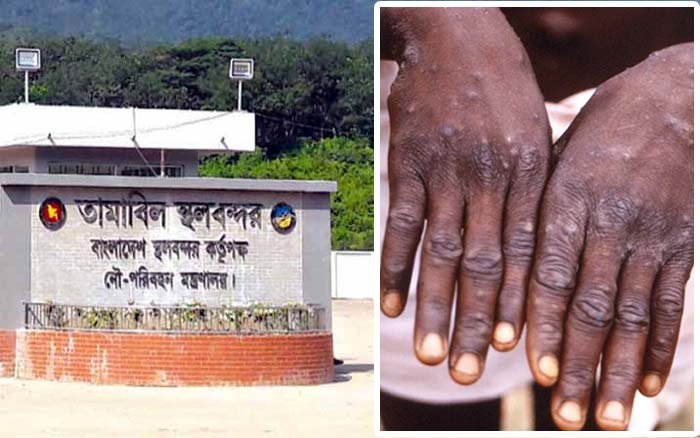 মাঙ্কিপক্স : সিলেটের স্থলবন্দরগুলোতে বাড়তি সতর্কতা