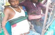 মৌলভীবাজারের আদম ব্যবসার টাকা নিয়ে কথা কাটাকাটির জের ধরে দুই ভাইকে ছুরিকাঘাত